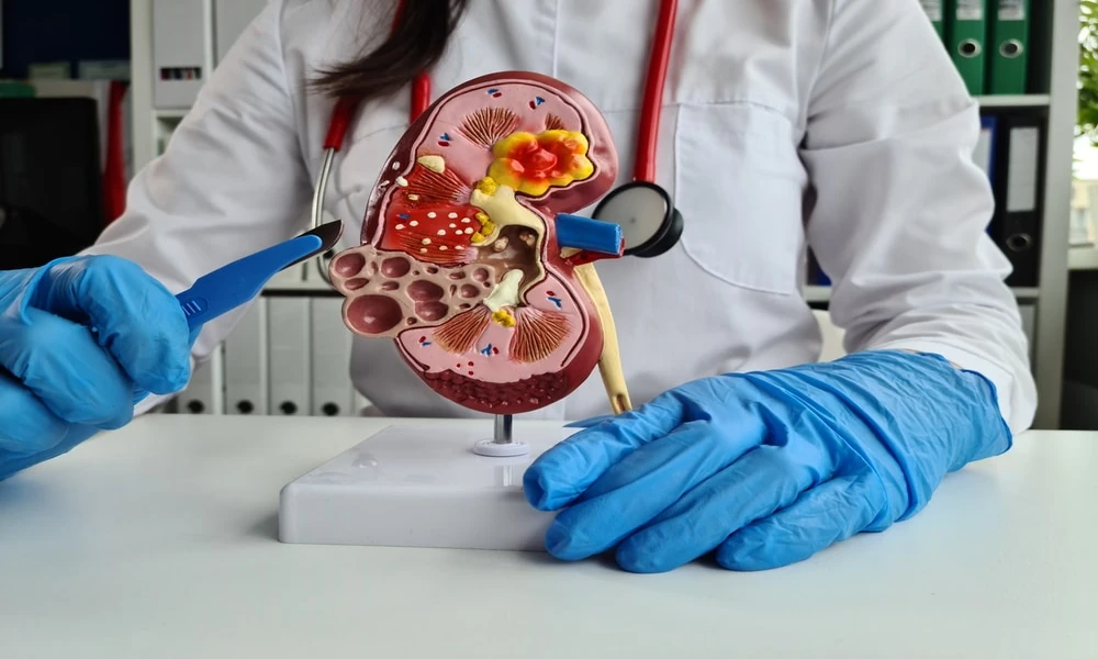 Learning about High-Standard Kidney Care Available Across San Antonio Medical Communities